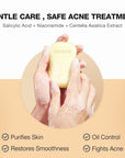 SKINEVER Salicylic Acid Refreshing Acne Soap