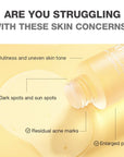 SKINEVER VITAMIN C BRIGHTENING TONER