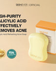 SKINEVER Salicylic Acid Refreshing Acne Soap