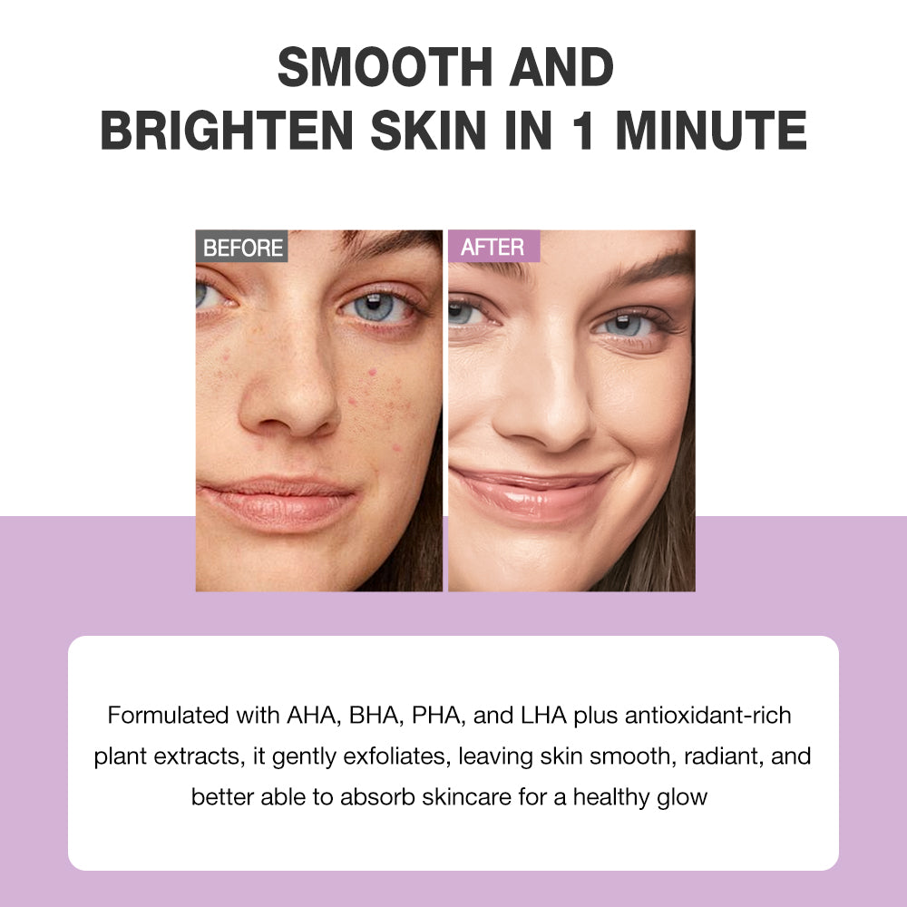 SKINEVER Glycolic Acid Deep Peeling Solution