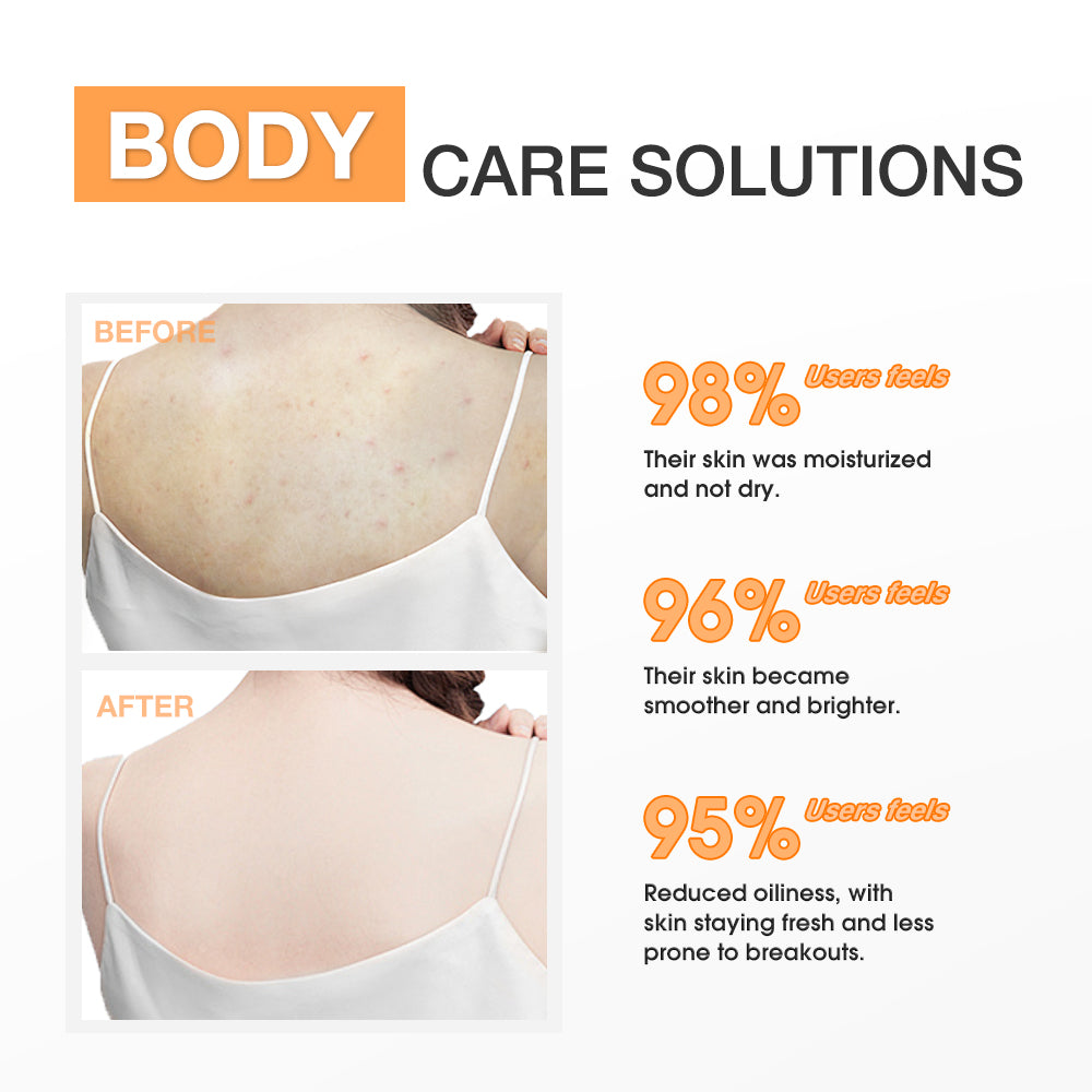 SKINEVER Salicylic Acid Exfoliating Body Lotion