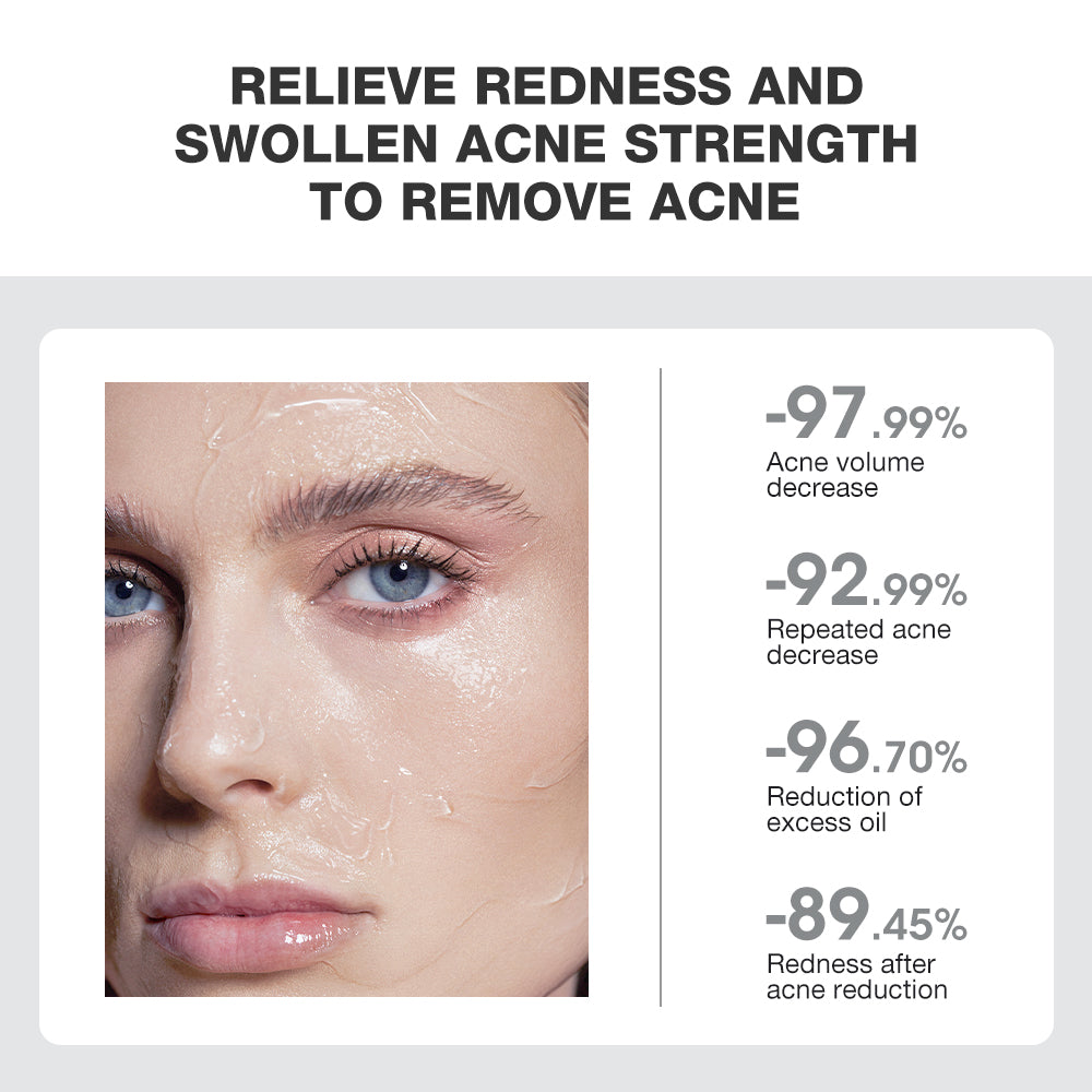 SKINEVER Salicylic Acid Acne Treatment Ice Sleep Masque