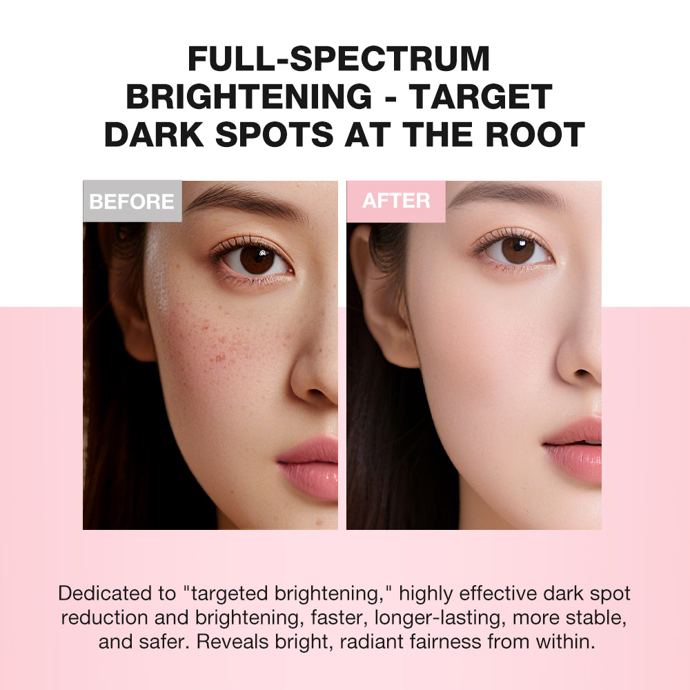 SKINEVER 10% Niacinamide Spot-Lightening Cream