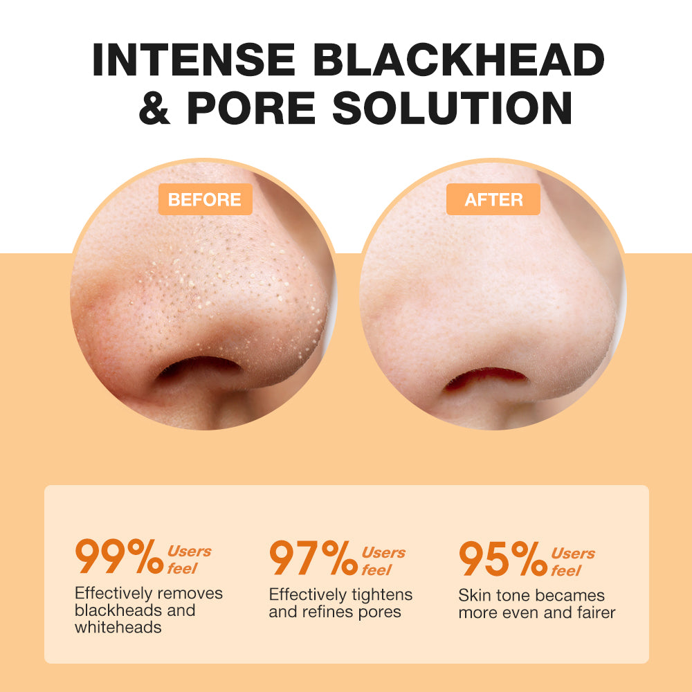 SKINEVER Salicylic Acid Blackhead Purifying &amp; Pore Minimizing Set