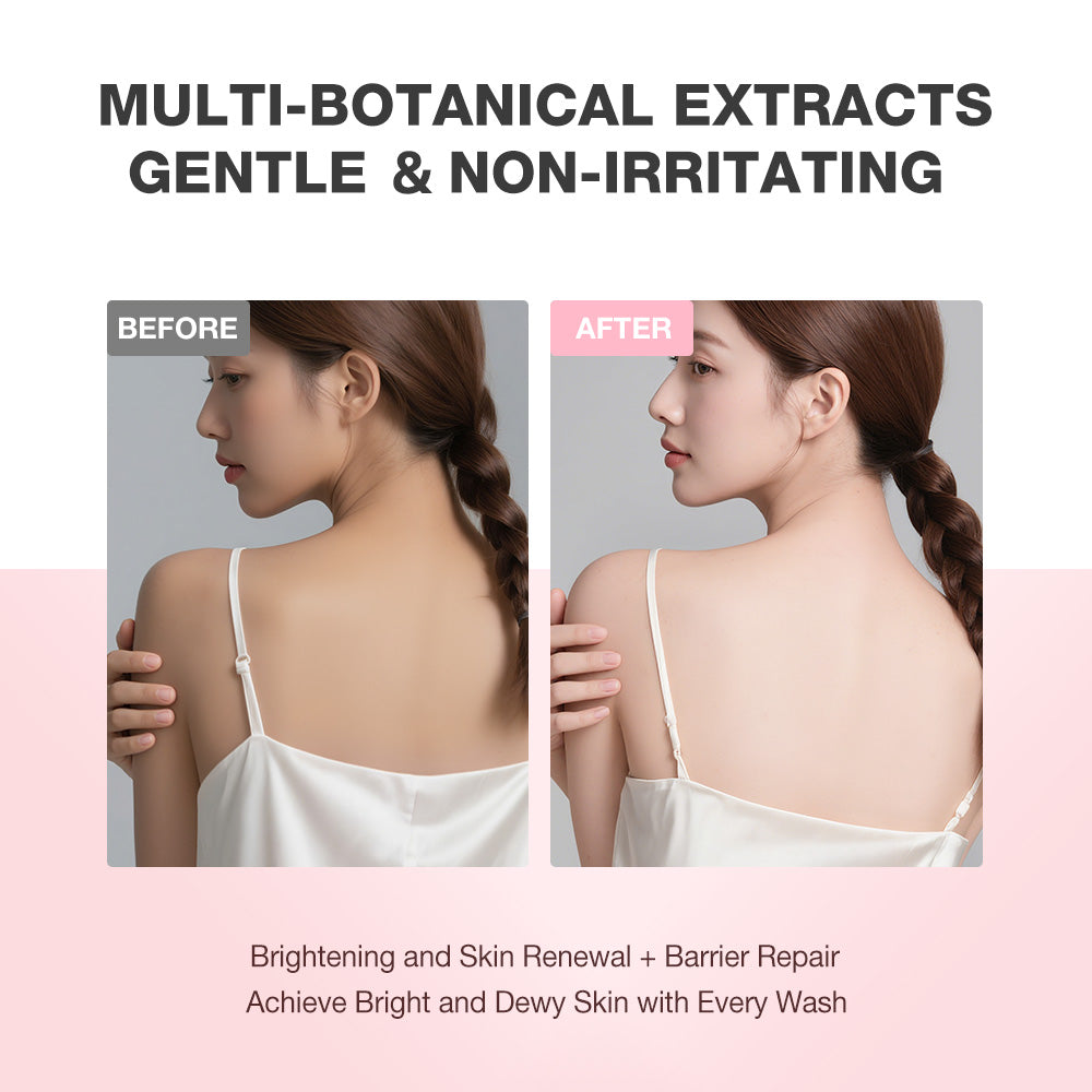 SKINEVER Niacinamide Skin Brightening Soap