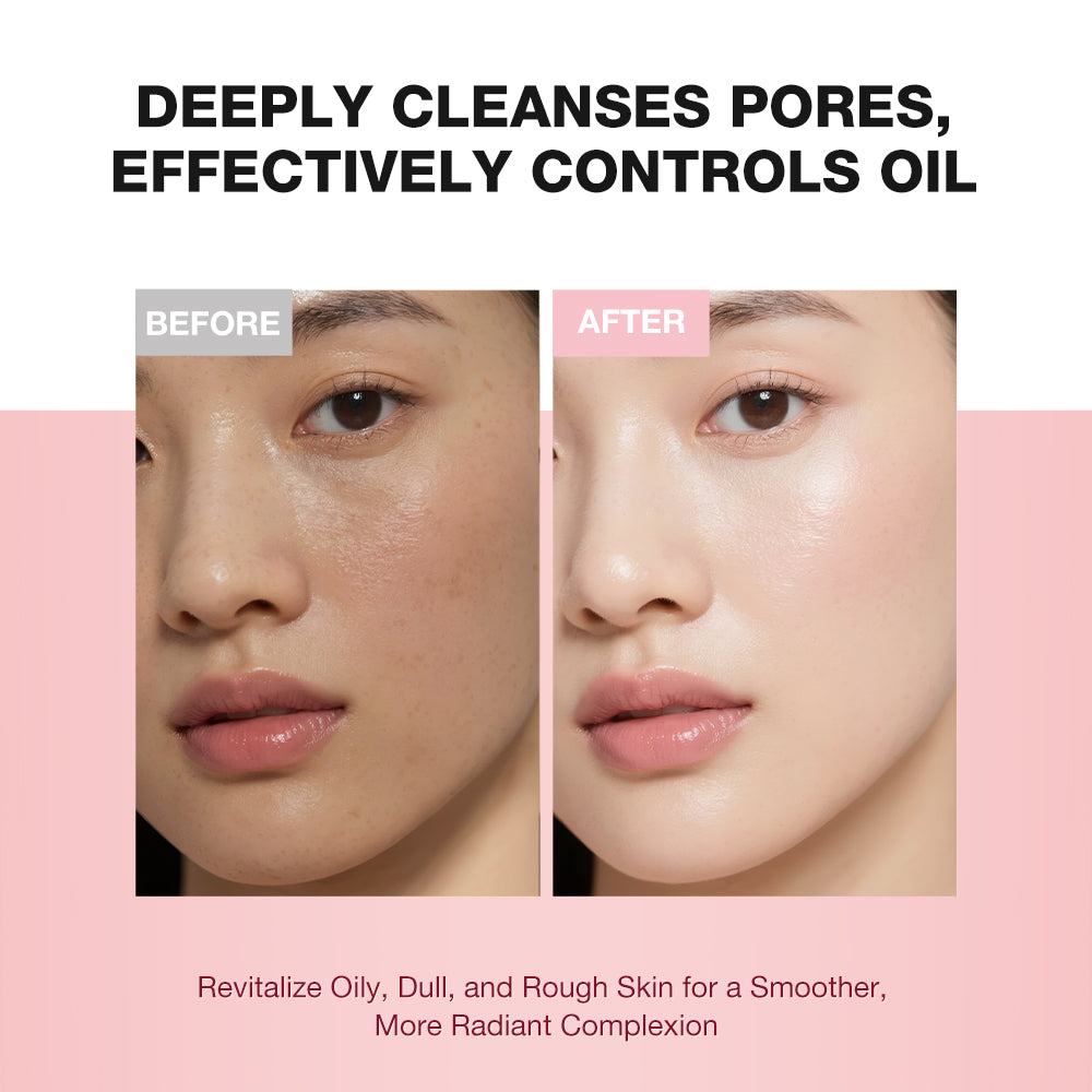 SKINEVER Niacinamide Brightening Scrub Cleanser