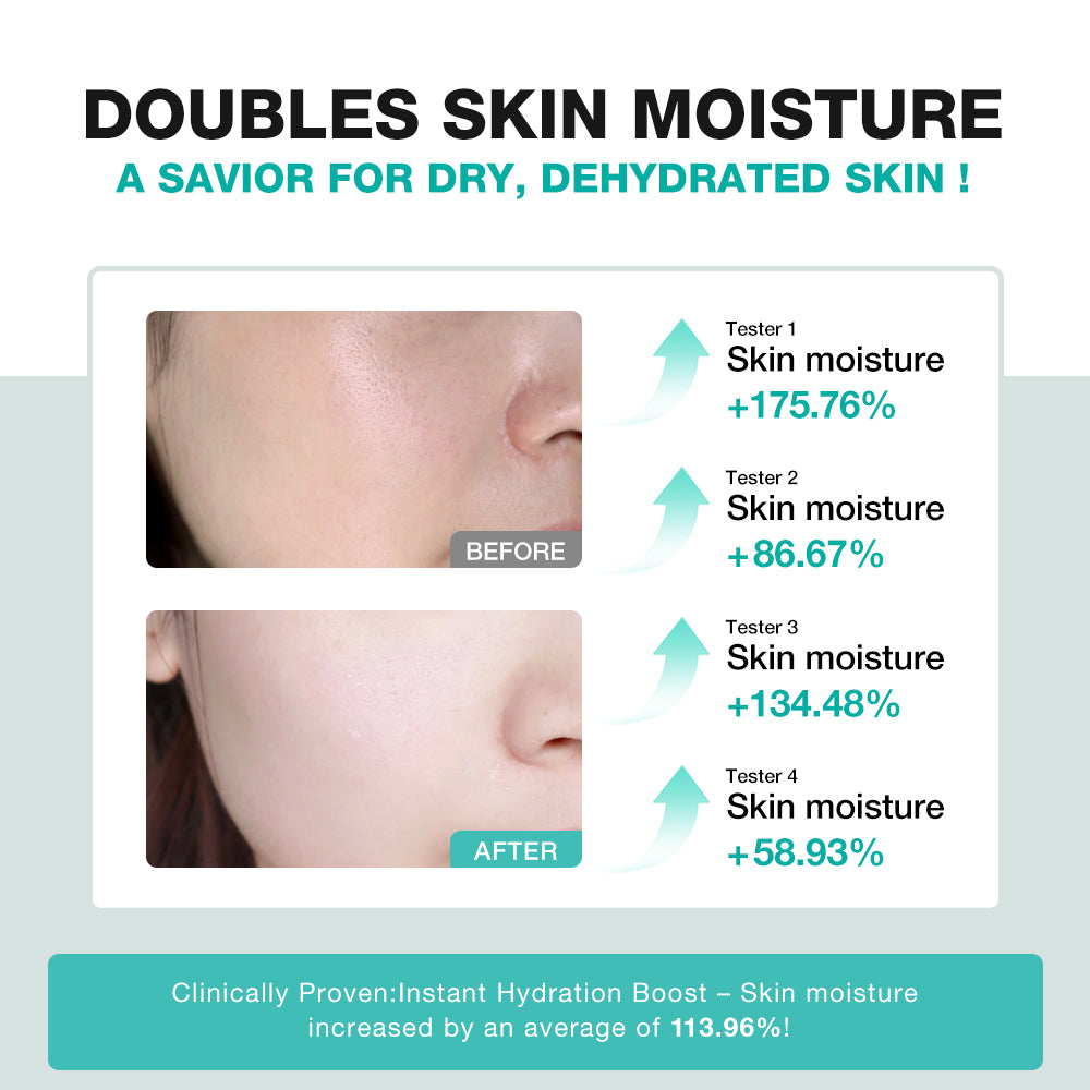 SKINEVER Centella Asiatica Soothing Cream