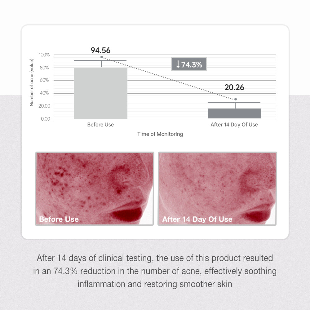 SKINEVER Salicylic Acid Anti Acne Serum
