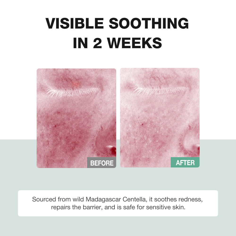 SKINEVER Centella Asiatica Soothing Serum