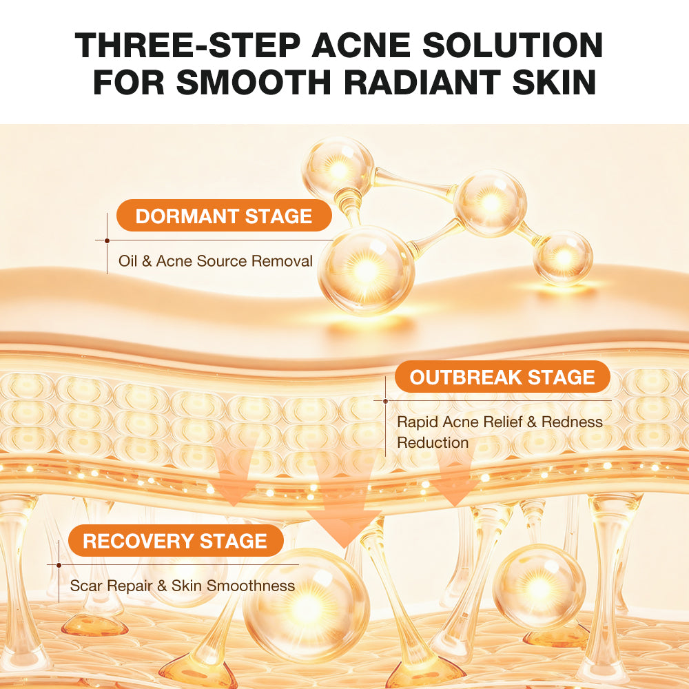 SKINEVER Salicylic Acid Refreshing Acne Skin Body Wash