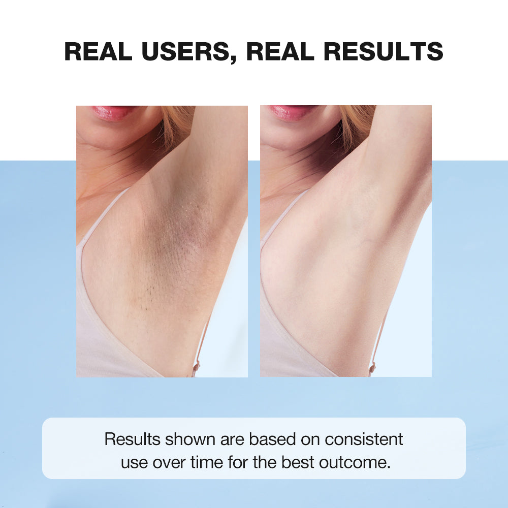 SKINEVER Deodorant Brightening Underarm Cream